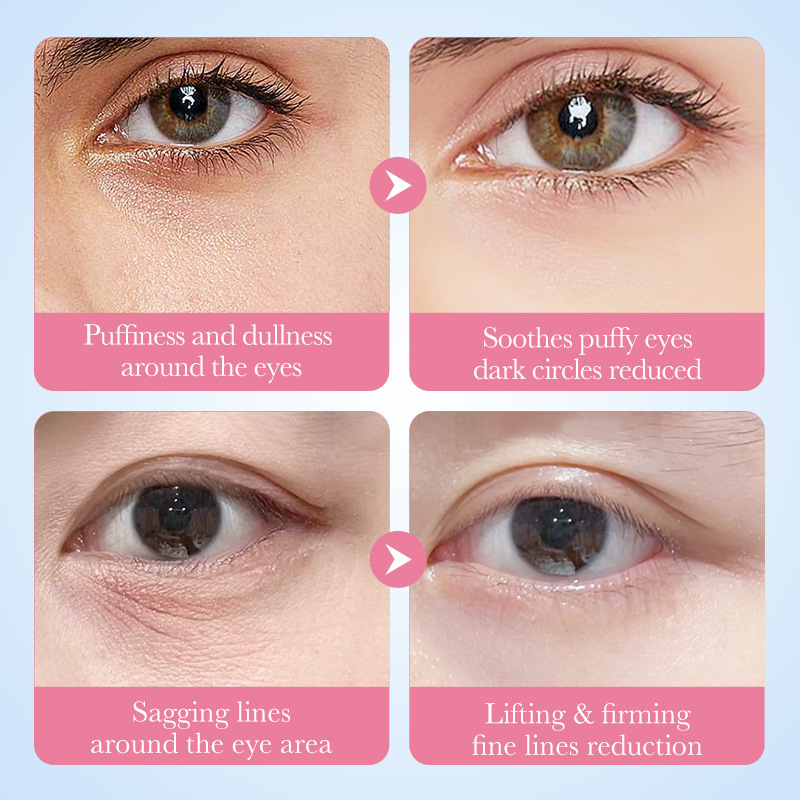 แผ่นมาส์กใต้ตาคอลลาเจนซากุระ 6 - Collagen Under Eye Patches บทวิจารณ์และราคา