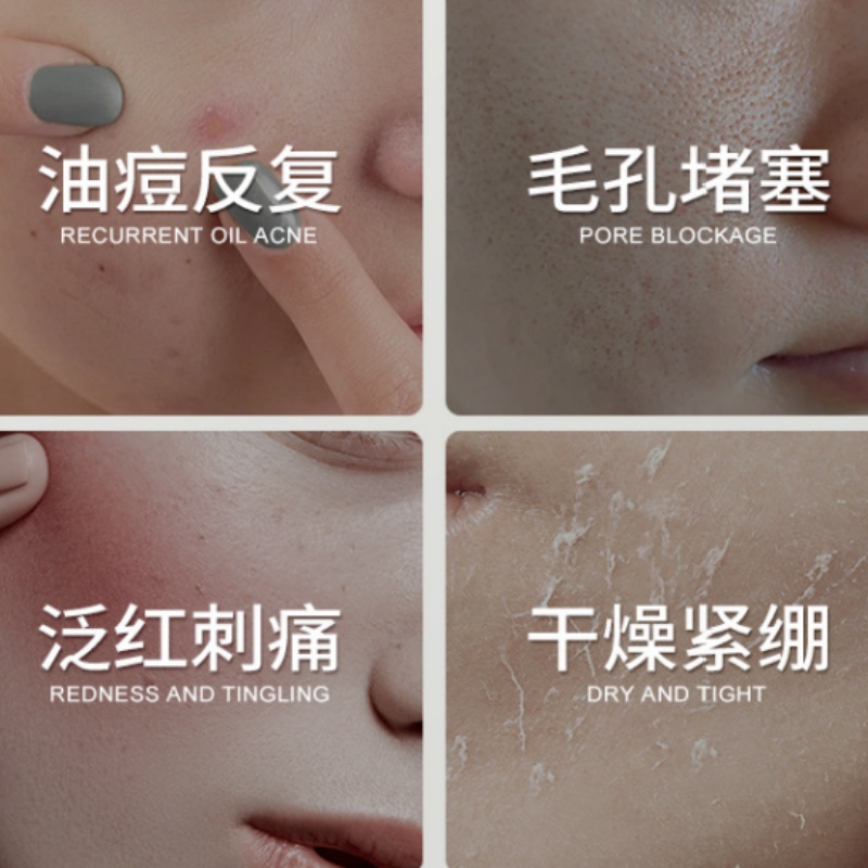 คลีนเซอร์หน้าสารสกัดใบบัวบกผสม - Salicylic Acid Blackhead Remover บทวิจารณ์และราคา